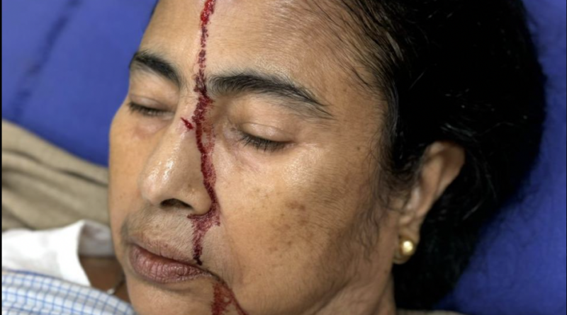 west bengal cm mamata banerjee gets injured