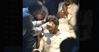 If the stone had hit lower, the CM would have lost his eye says doctor