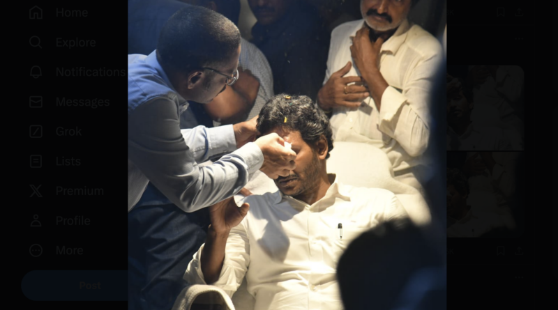 If the stone had hit lower, the CM would have lost his eye says doctor