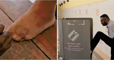 man votes with his leg