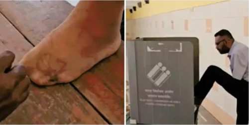 man votes with his leg