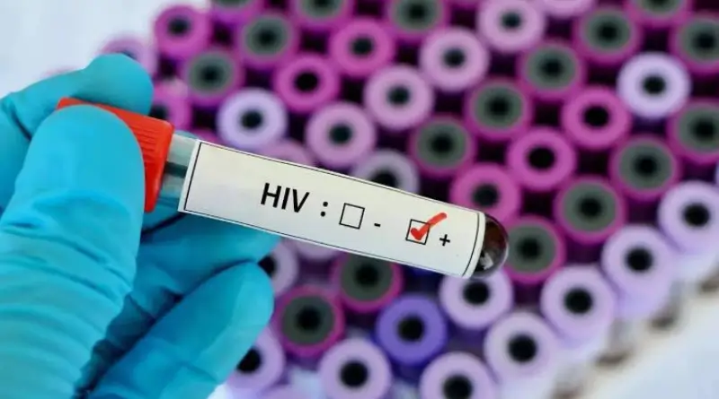 47 students died of hiv in tripura