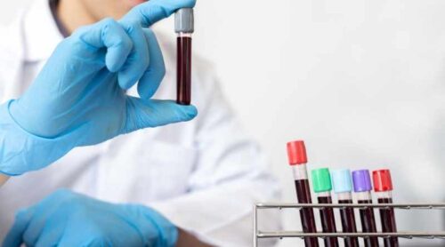 game changing blood test that detect 12 cancers